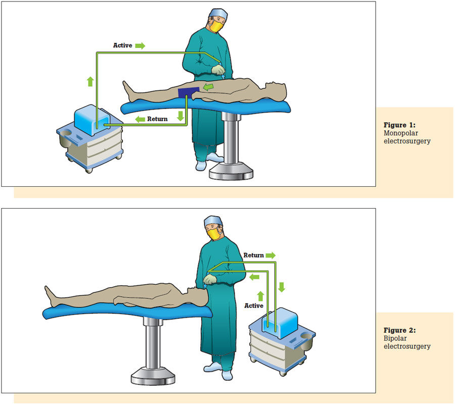 10 Best Practices for Electrosurgical Unit Testing Fluke Biomedical